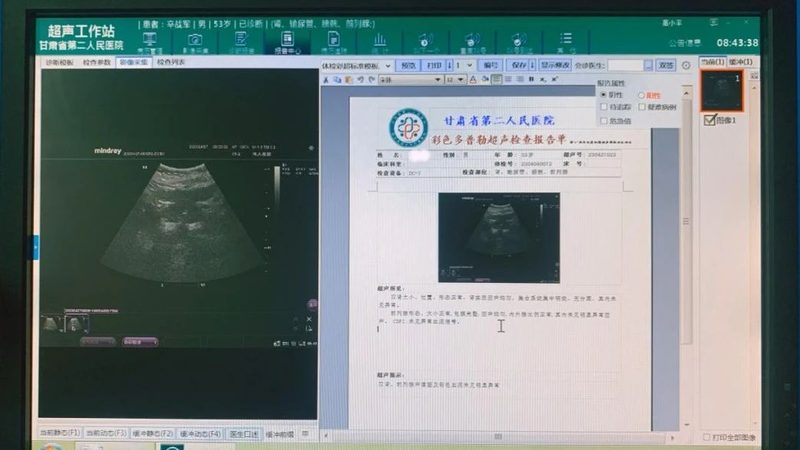 体检套餐材质参数定制：揭秘背后的技术逻辑**